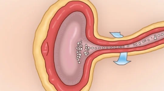 how-to-apply-betamethasone-for-phimosis