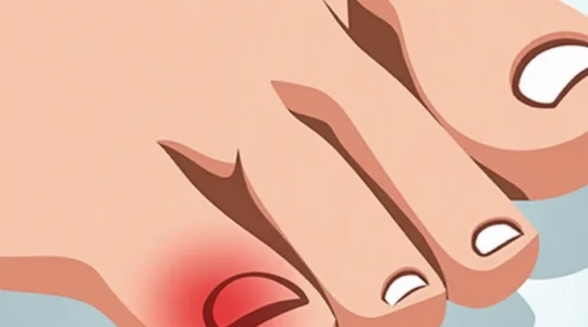 black-spot-under-toenail-causes